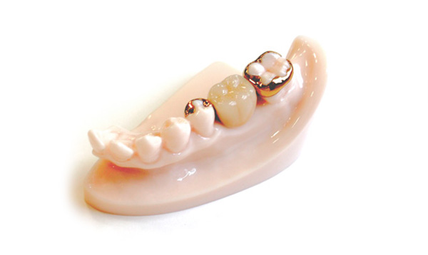 ���ʂ����Ȃ��q���[�}���u���b�W�E�ڒ��u���b�W�E�����s�`�斃�z�\��