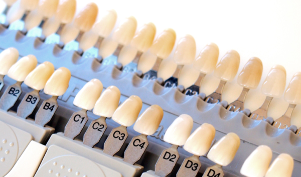 �ڒ��u���b�W�͎������܂���E�����s�`�斃�z�\�Ԃ̎��Ȉ�@