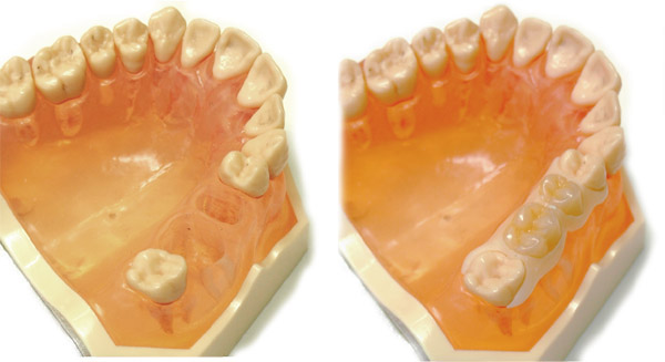 �E�F���f���c�E���O����u���b�W�E�������Ȃ��u���b�W�E�����s�`�斃�z�\��