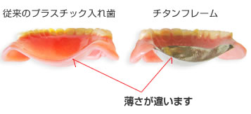 �����̓��ꎕ�E�ی��̓��ꎕ�ƃ`�^���`���̔�r