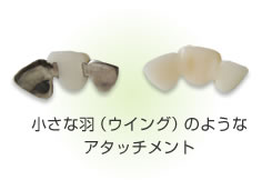 �E�C���O�A�^�b�`�����g�E�������ꎕ